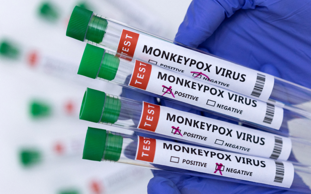 Sobre la vacuna para la viruela del mono